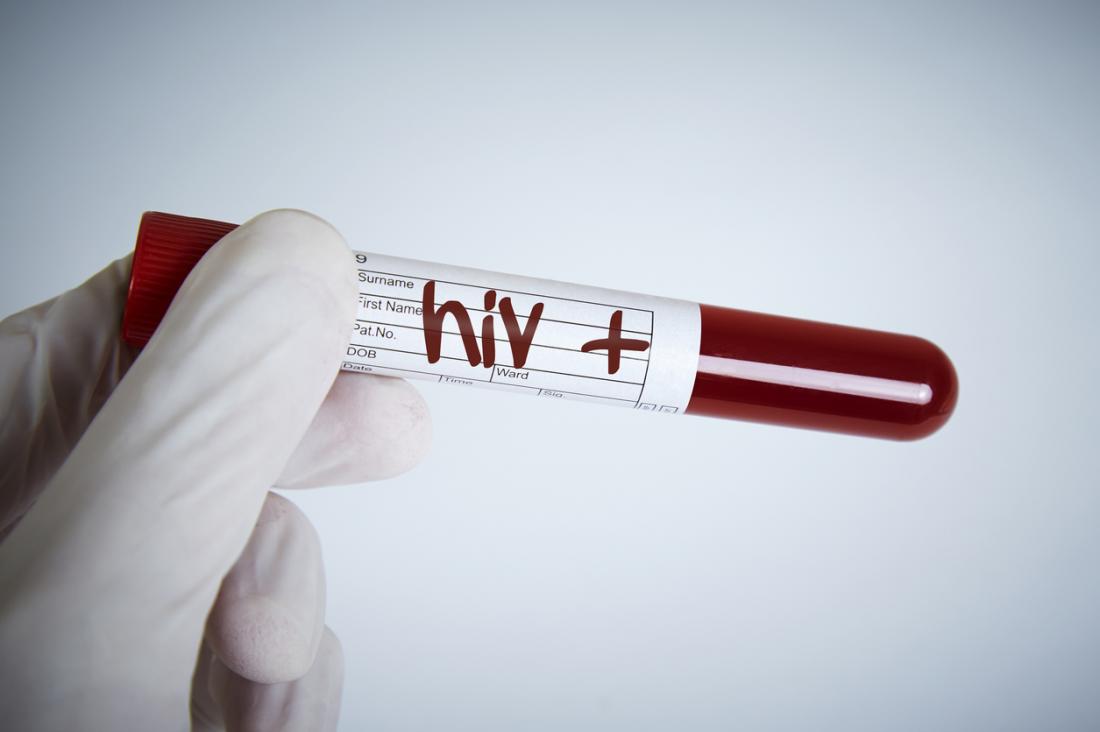 test-tube-showing-hiv-positive-results.jpg