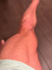 legs.jpeg legs.jpeg