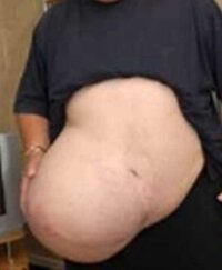 VZJSYV6X6IXT3HYDLS6M~2.jpg VZJSYV6X6IXT3HYDLS6M~2.jpg