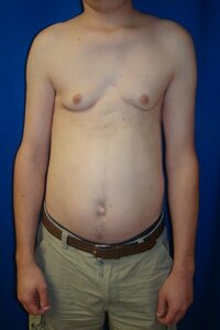 gyno.jpg